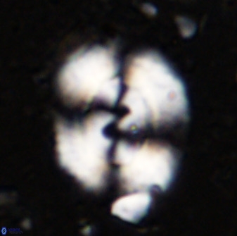 Watznaueria cynthae 36410