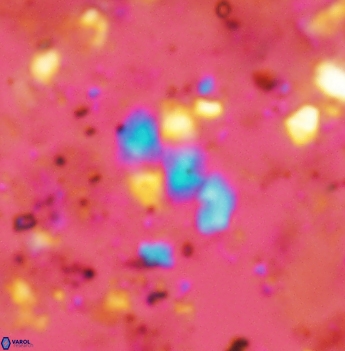 Watznaueria diaphanae 2536
