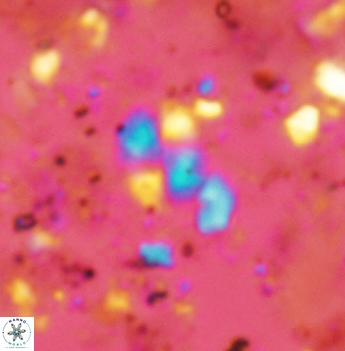 Watznaueria diaphanae 2536