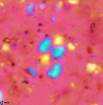 Watznaueria diaphanae 2537