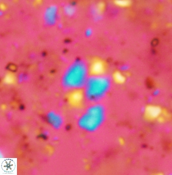 Watznaueria diaphanae 2537