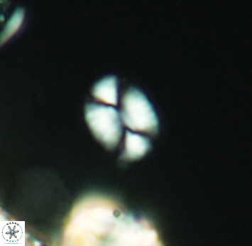 Watznaueria diaphanae 2746