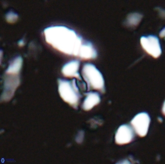 Watznaueria duolamina 13284