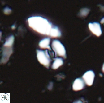 Watznaueria duolamina 13284