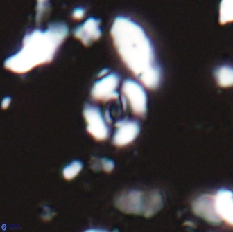 Watznaueria duolamina 13286