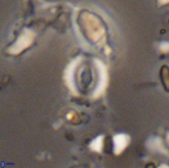 Watznaueria duolamina 13290