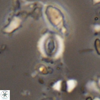 Watznaueria duolamina 13290