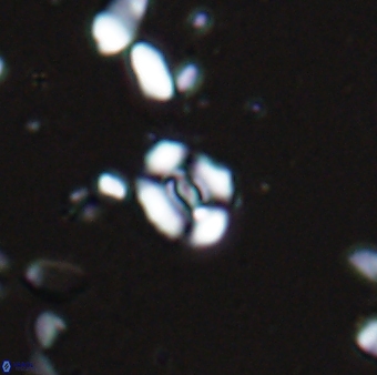 Watznaueria duolamina 13337