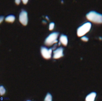 Watznaueria duolamina 13341