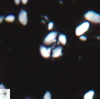 Watznaueria duolamina 13341