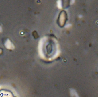 Watznaueria duolamina 13343