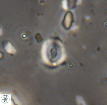 Watznaueria duolamina 13343