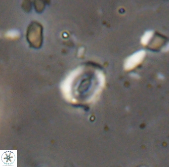 Watznaueria duolamina 13344