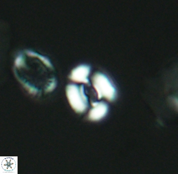 Watznaueria duolamina 2747