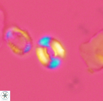 Watznaueria duolamina 2748