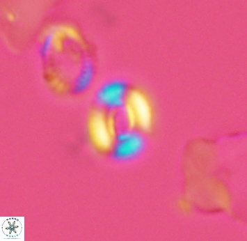 Watznaueria duolamina 2749