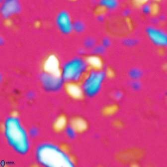 Watznaueria duolamina 7632
