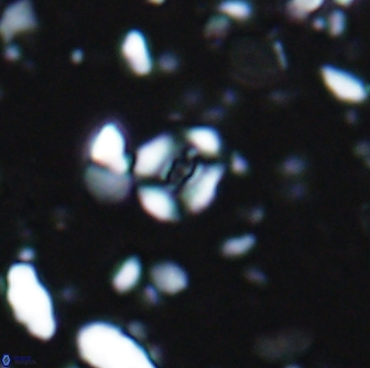 Watznaueria duolamina 7633