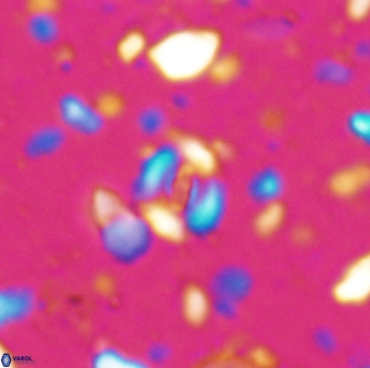 Watznaueria duolamina 7634