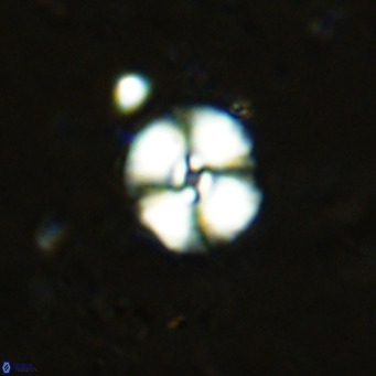 Watznaueria fossacincta VR 15812