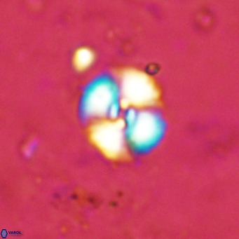 Watznaueria fossacincta VR 15815