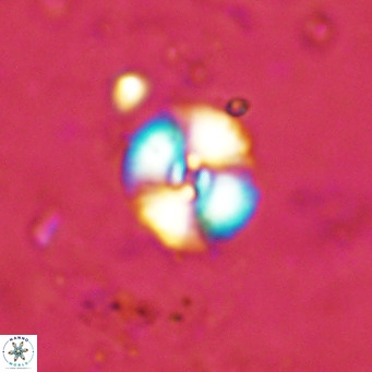 Watznaueria fossacincta VR 15815