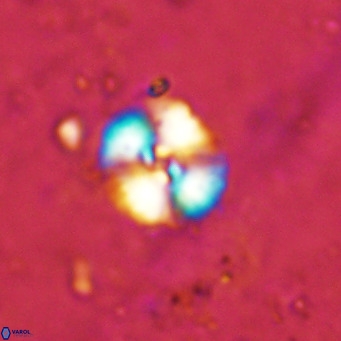 Watznaueria fossacincta VR 15818