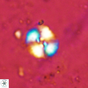 Watznaueria fossacincta VR 15818
