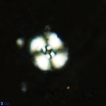 Watznaueria fossacincta VR 15819