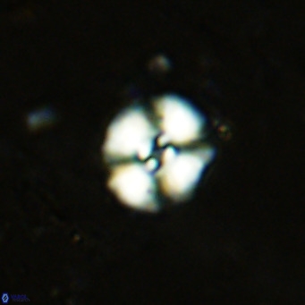 Watznaueria fossacincta VR 15820