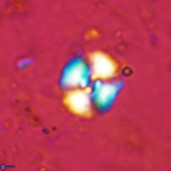 Watznaueria fossacincta VR 15821