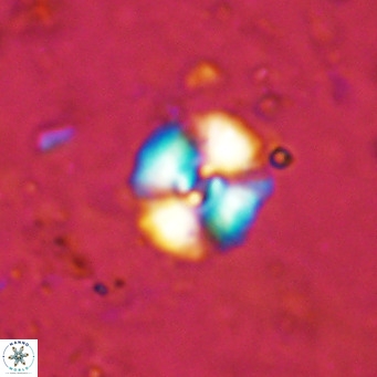 Watznaueria fossacincta VR 15821