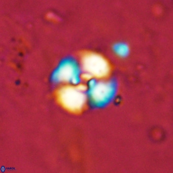 Watznaueria fossacincta VR 15824
