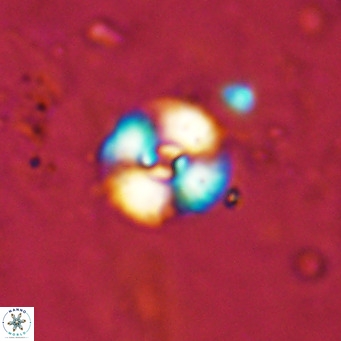 Watznaueria fossacincta VR 15824