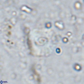 Watznaueria fossacincta VR 15825