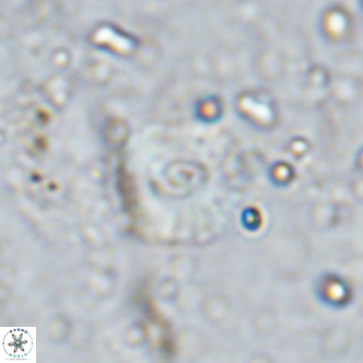 Watznaueria fossacincta VR 15825