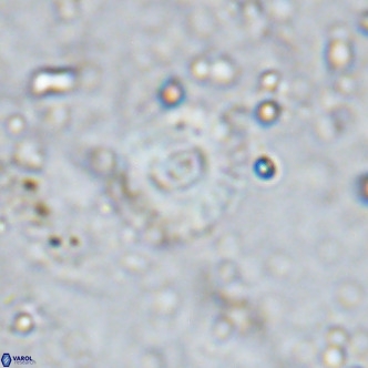 Watznaueria fossacincta VR 15826
