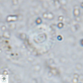 Watznaueria fossacincta VR 15826