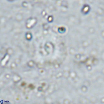 Watznaueria fossacincta VR 15827