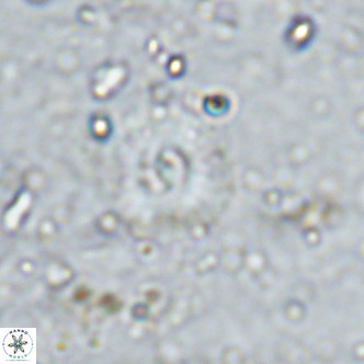 Watznaueria fossacincta VR 15827