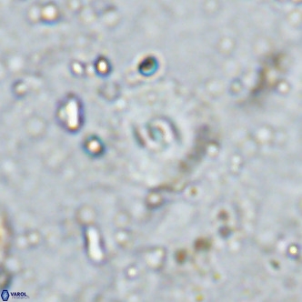 Watznaueria fossacincta VR 15828