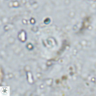 Watznaueria fossacincta VR 15828