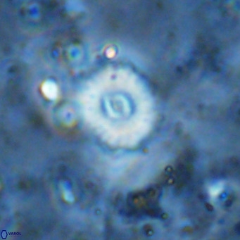 Watznaueria fossacincta VR 15829