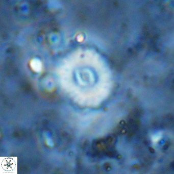 Watznaueria fossacincta VR 15829