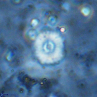 Watznaueria fossacincta VR 15830