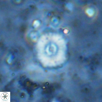Watznaueria fossacincta VR 15830
