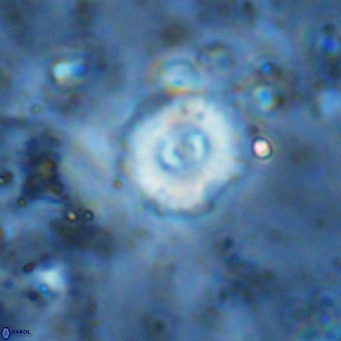 Watznaueria fossacincta VR 15831