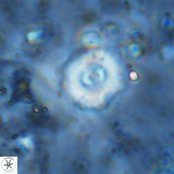 Watznaueria fossacincta VR 15831
