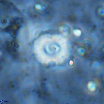 Watznaueria fossacincta VR 15832