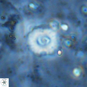 Watznaueria fossacincta VR 15832